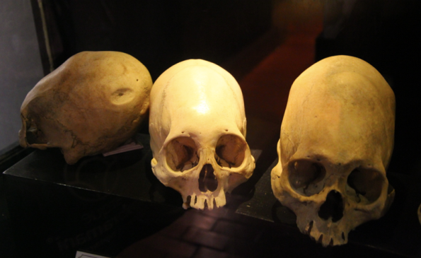 Museo de Sitio del Qoricancha, skulls 